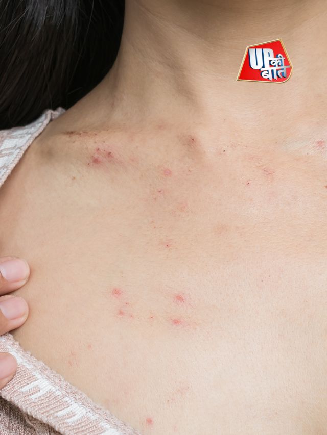 हमारे शरीर में खुजली क्यों होती है?