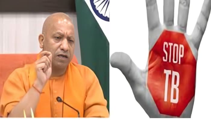 UP News: लखनऊ में फरवरी से शुरू होगा 100 दिन का मेगा टीबी मुक्त अभियान