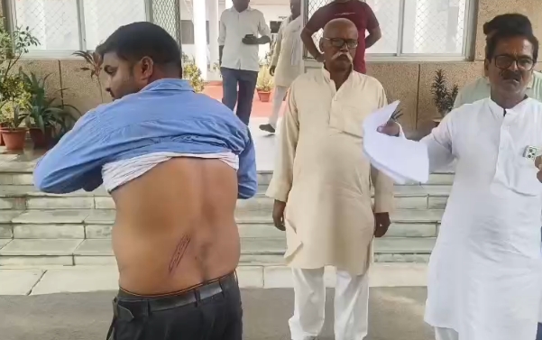 बेरहम खाकी पर गंभीर आरोप: संतकबीरनगर में युवक ने पुलिसकर्मियों पर मारपीट और अमानवीय व्यवहार का लगाया आरोप